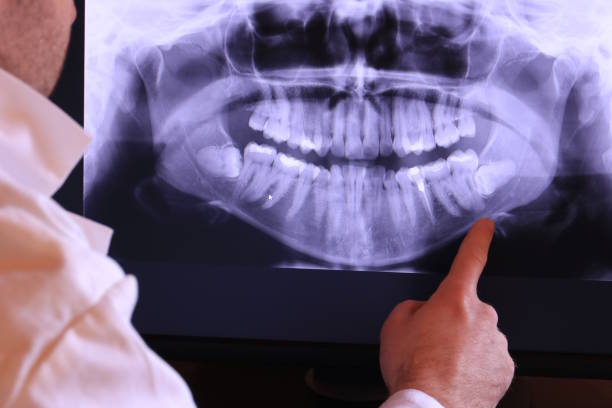 Best Dentist for Tooth Abscess  in Jemison, AL